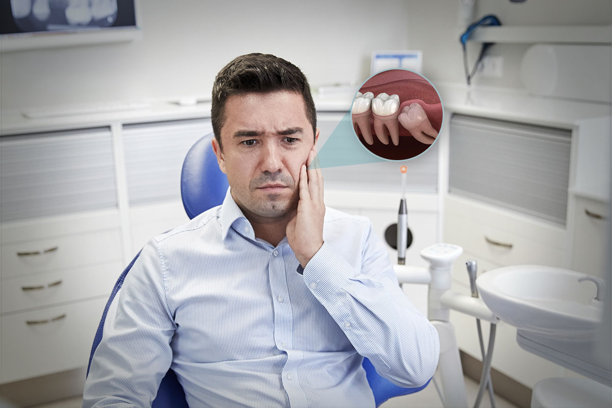 Wisdom-Tooth-Removal