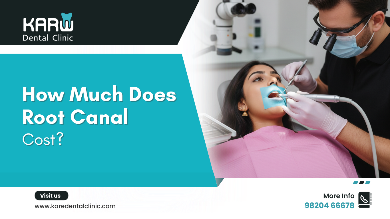 How Much Does a Root Canal Cost?