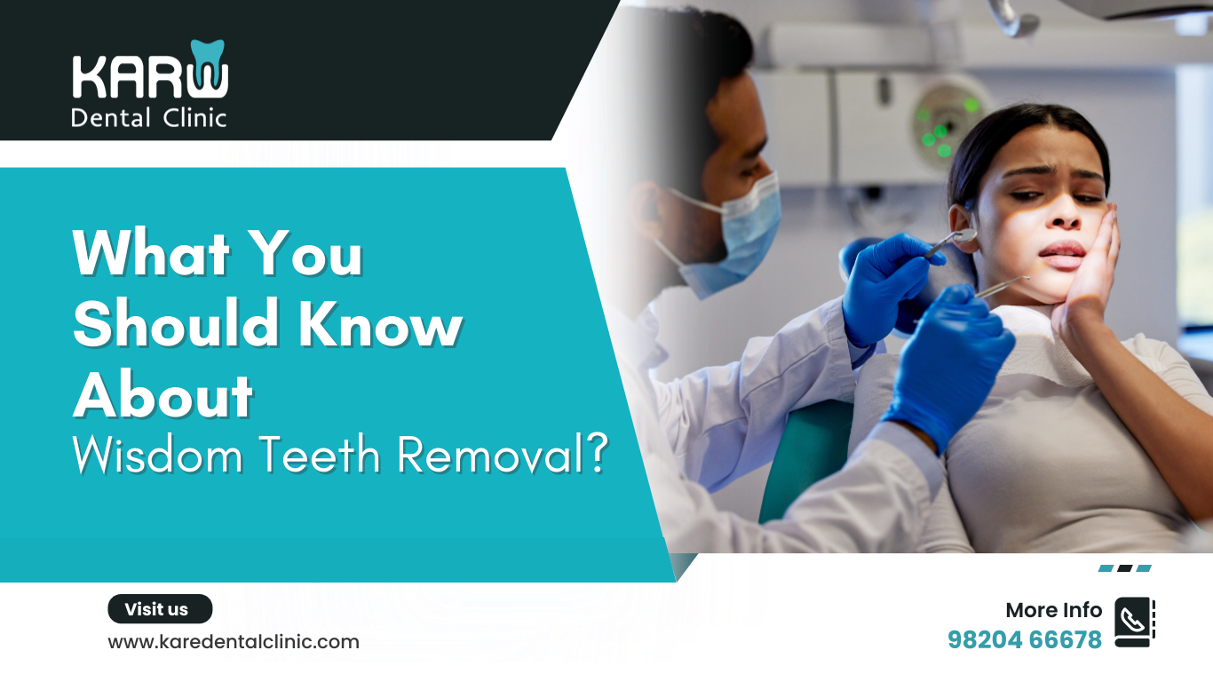 What You Should Know About Wisdom Teeth Removal